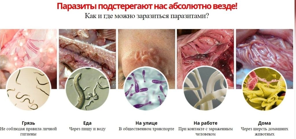 Detoxic ΠΎΡ ΠΏΠ°ΡΠ°Π·ΠΈΡΠΎΠ² ΠΎΡ ΡΠ΅Π³ΠΎ