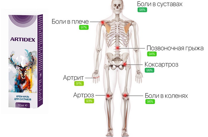 Artidex для суставов: восстановит естественное состояние костной и хрящевой систем!