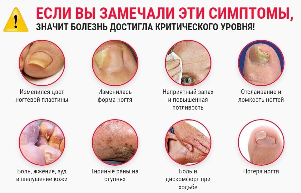 Micolock от грибка ногтей от чего
