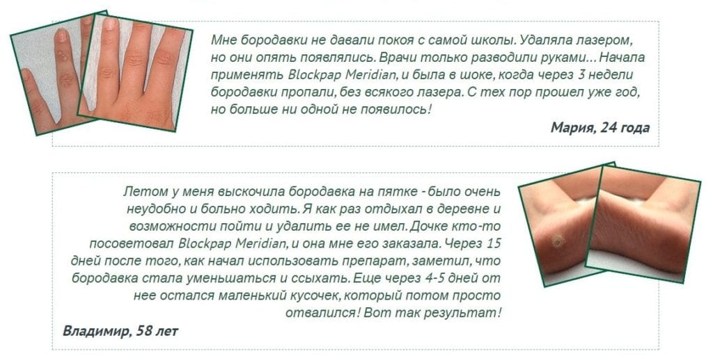Blockpap Meridian ΠΎΡ ΠΏΠ°ΠΏΠΈΠ»Π»ΠΎΠΌ ΠΎΡΠ·ΡΠ²Ρ