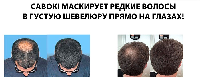 Эффективность загустителя волос Caboki (Кабоки) для мужчин