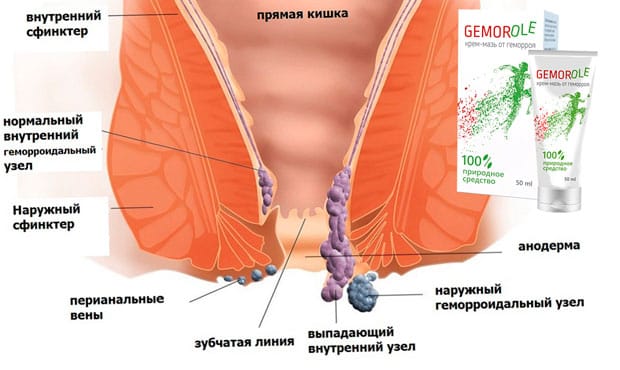 Gemorole средство от геммороя цена