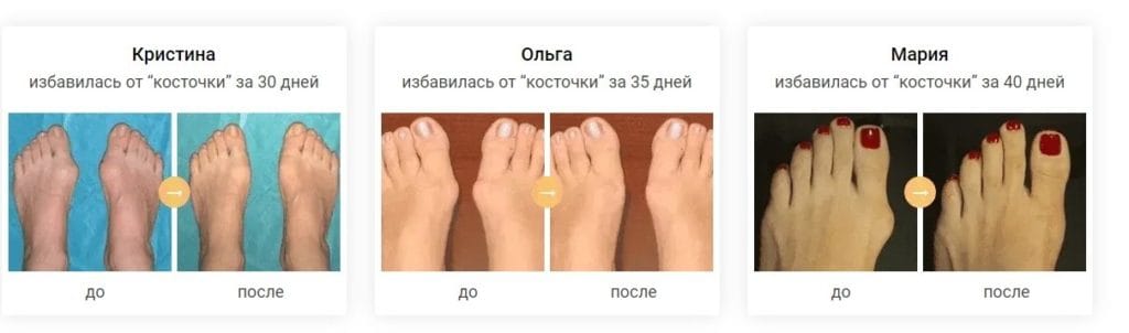 Вальгурон - отзывы реальных покупателей