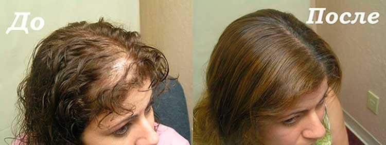До и после применения Princess Hair