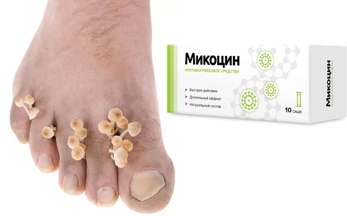 Микоцин актив комплекс от грибка таблетки и гель: возвращает здоровье и эстетичный вид ногтям!