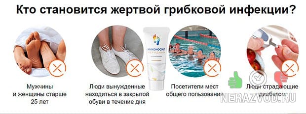 Грибковые поражения стоп