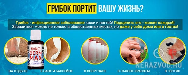 Микоз