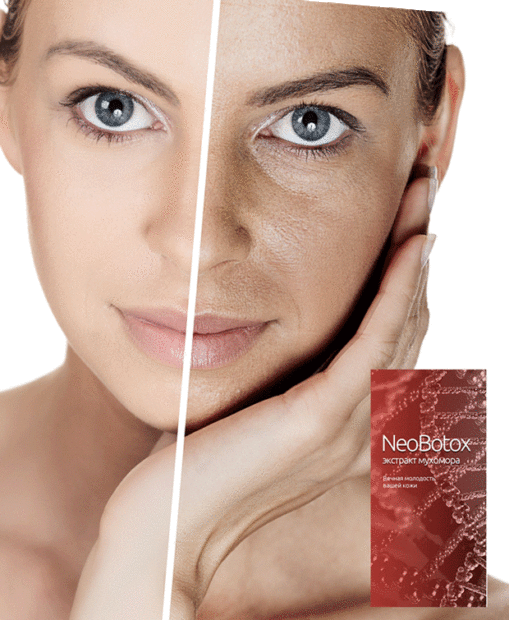 neobotoks1