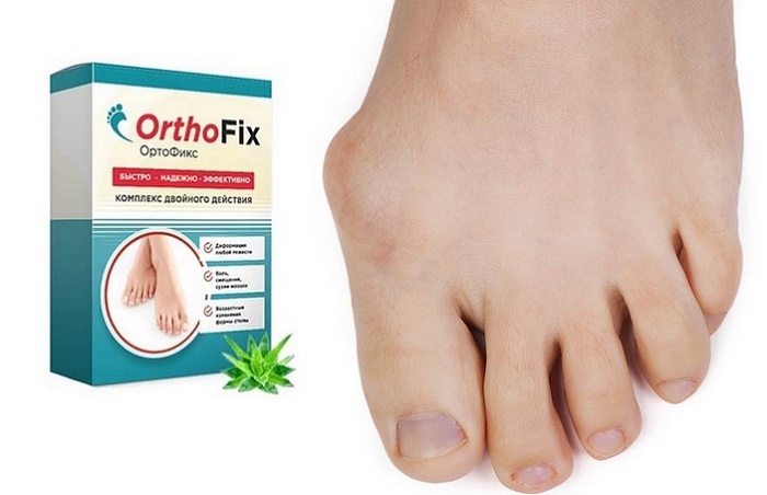 Ортофикс от вальгуса стопы и косточки на большом пальце: теперь ноги красивые и здоровые всегда!