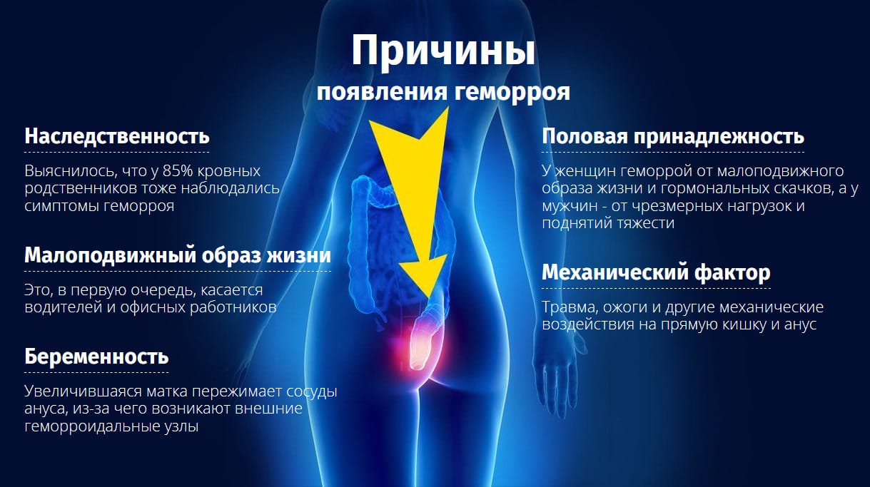Крем Здоров от геморроя причины