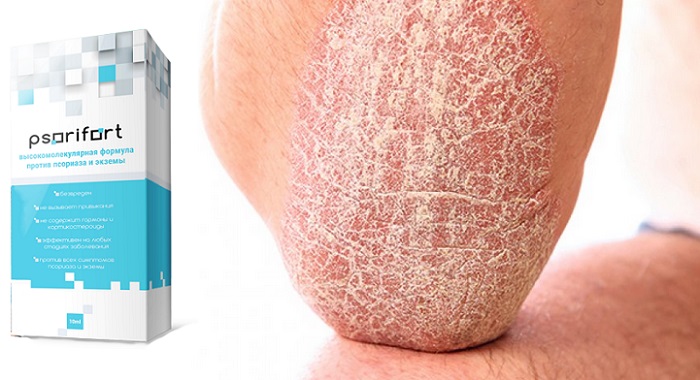 Psorifort от псориаза: лучший комплекс для очищения и оздоровления кожи лица и тела!