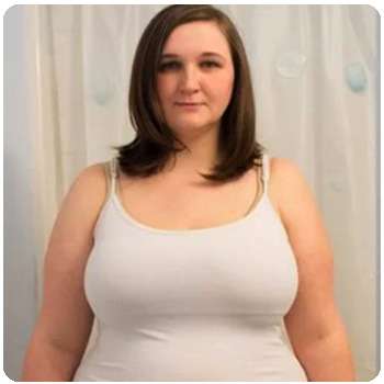 Женщина до применения капсул для похудения Stop Weight.